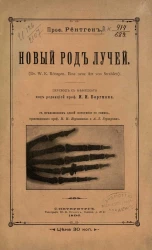 Новый род лучей